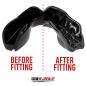 SafeJawz Intro Series Black Mouthguard - Before/After