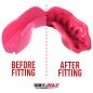SafeJawz Intro Series Pink Mouthguard - Before/After