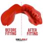 SafeJawz Intro Series Red Mouthguard - Before/After